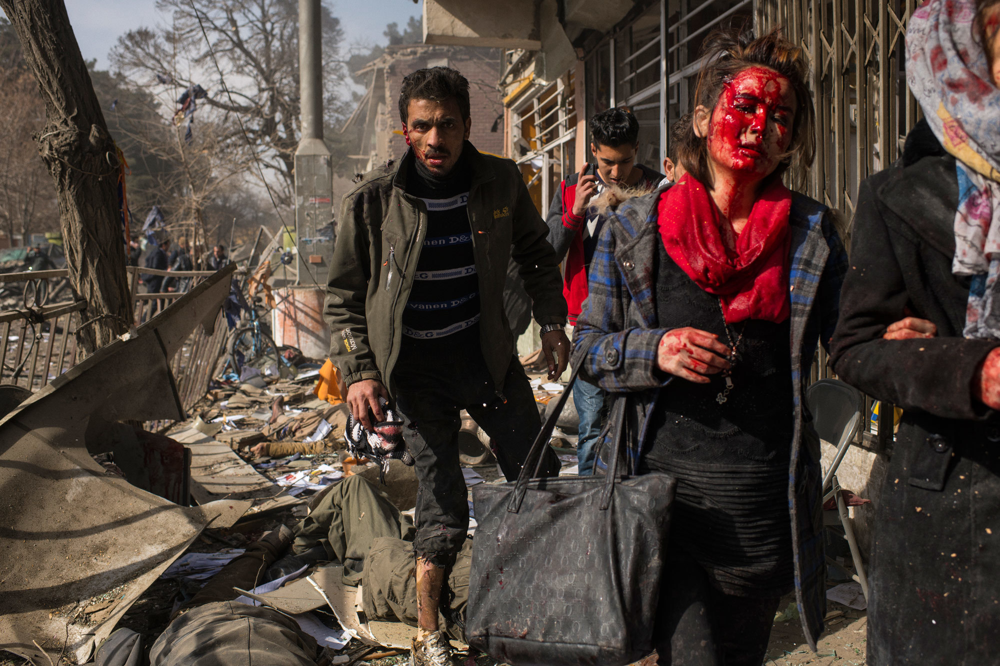 Spot news, storie. Dopo l’esplosione di una bomba a Kabul, in Afghanistan, gennaio 2018. - (Andrew Quilty per il New York Times)
